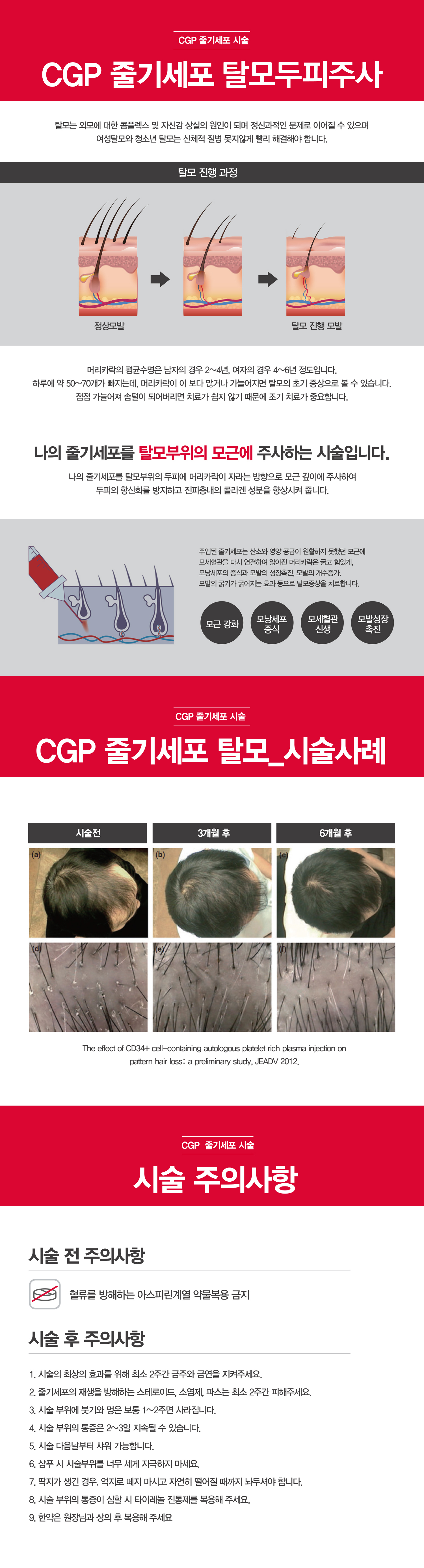 서브 콘텐츠 이미지